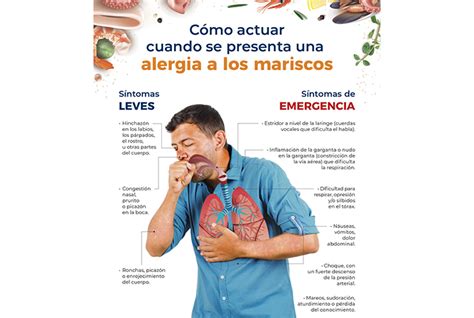 Alergia a los mariscos .